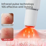 Electronic Mosquito Bite Pen Chemical-Free Heat Relief