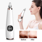 Electric Blackhead Removal Pore Cleaning Device