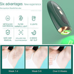 Full-Body Pulse Light Hair Removal Home Use